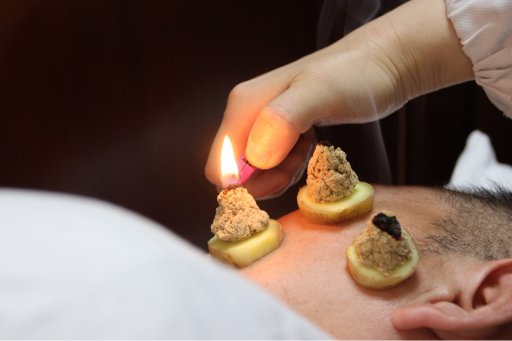 Acupuncture Therapy (Ma-style Facial Palsy Therapy) (Municipal-level)